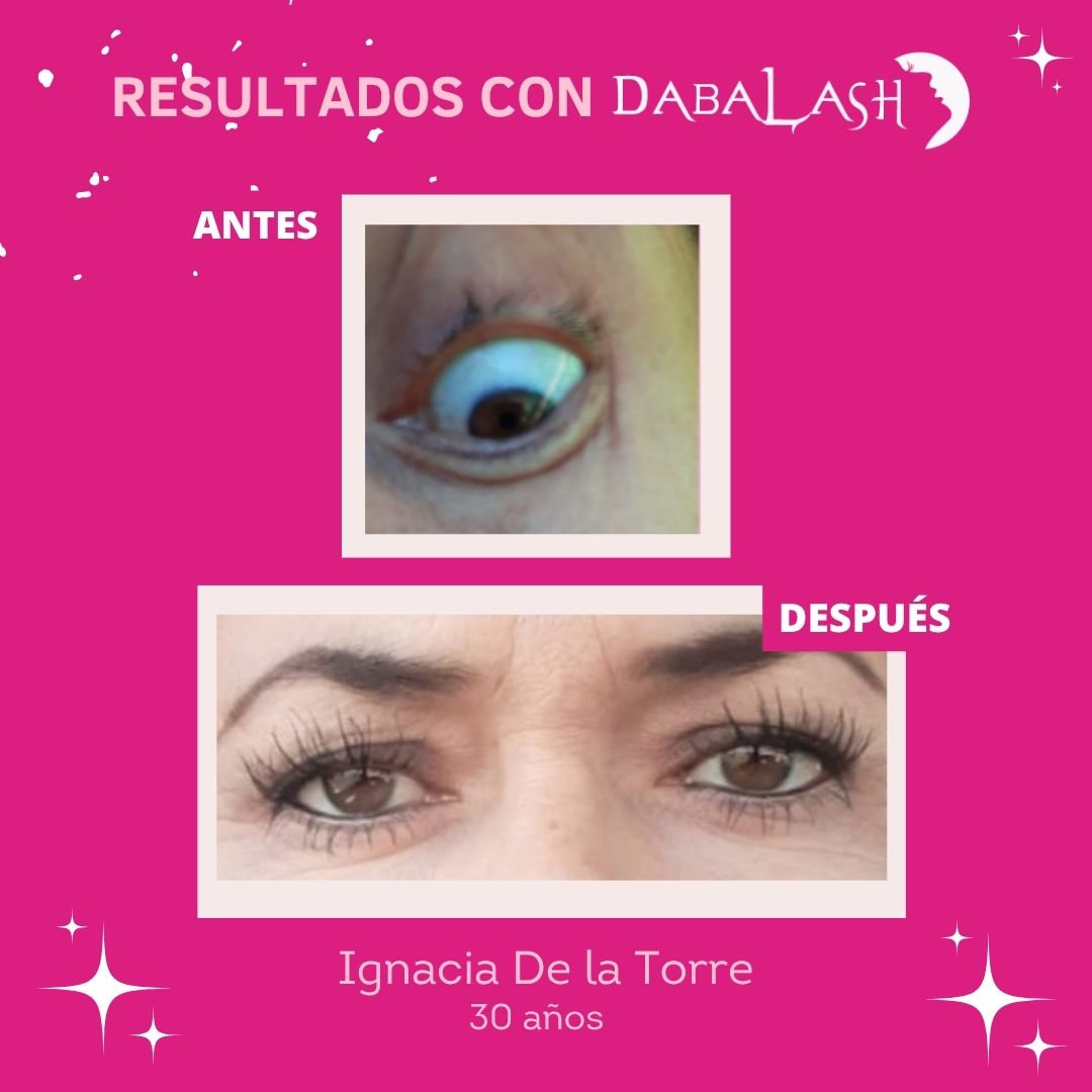 Testimonios de crecimiento de pesta&ntilde;as 